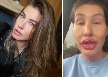 ”ცოტა ფილერი გავიკეთე სახეზე და ტუჩზე” – ქეთა თოფურიას ვიდეოს დიდი გამოხმაურება მოჰყვა