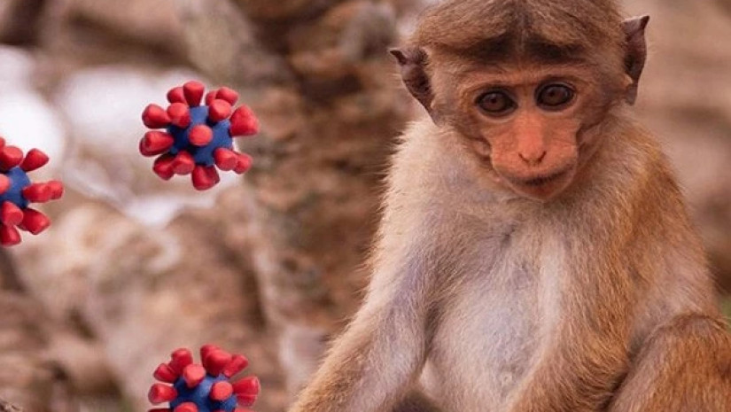 საქართველოში „მაიმუნის ყვავილის“ ერთ საეჭვო შემთხვევას იკვლევენ