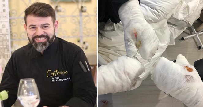 ”ეს რა დღეში ყოფილხარ გურამ, ვაიმეე…” – გურამ ბაღდოშვილმა კლინიკიდან უმძიმესი კადრები გამოაქვეყნა