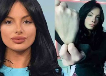 როცა მეუბნებიან რა გადარდებს, უპრობლემო ცხოვრება გაქვს…. აი ჩემი ხელი… – რა სჭირს ბაგირას ხელზე?!