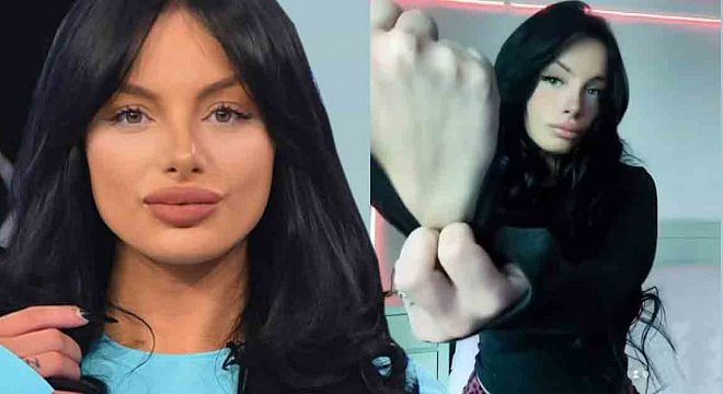 როცა მეუბნებიან რა გადარდებს, უპრობლემო ცხოვრება გაქვს…. აი ჩემი ხელი… – რა სჭირს ბაგირას ხელზე?!