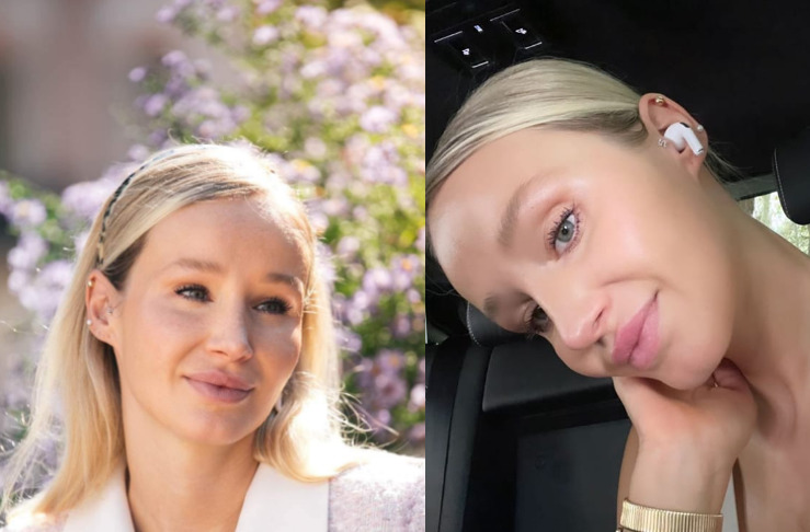 „დიახ ეს მე ვარ. უამრავ ადამიანს აწუხებს..” – რა სჭირსს ანუკის სახეზე ? – დიზაინერი მოულოდნელ ფოტოს აქვეყნებს