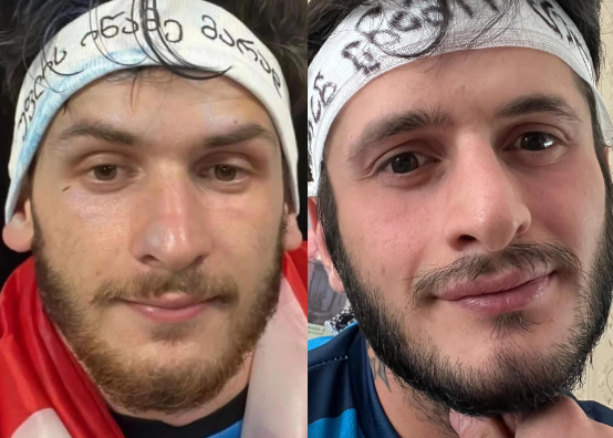 “დავდივარ ნაპოლის ქუჩებში და მთხოვენ ფოტოს გადაღებას..” – ვინ არის ხვიჩა კვარაცხელიას ქართველი ორეული