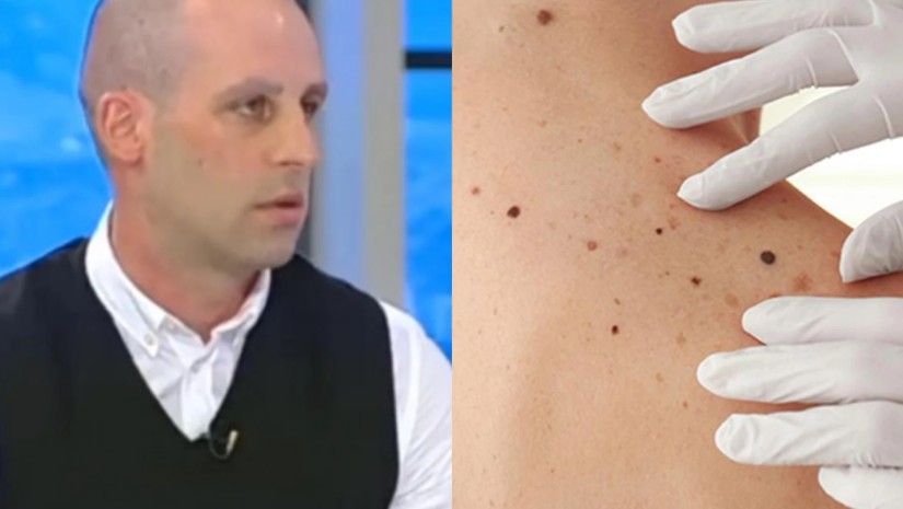 “თუ ასეთი ხალი გაქვთ სიცოცხლისთვის საშიშია” – ზაზა თელია გვეუბნება, თუ რა დროსაა მდგომარეობა საგანგაშო