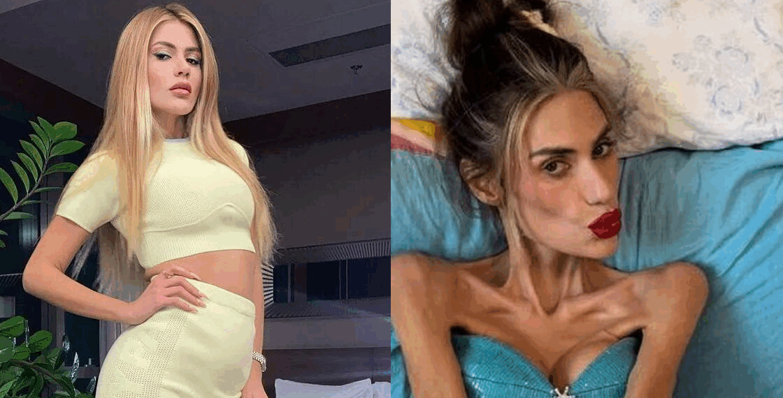 ცნობილი თურქი ვარსკვლავის ჯანმრთელობის მდგომარეობა უკიდურესად მძიმეა – რა დაემართა ნიჰალ ჯანდანს ?