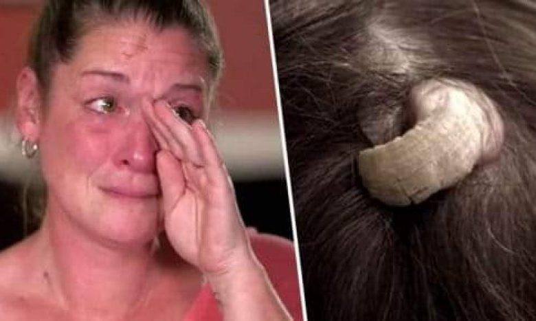 (ვიდეო) მედიცინა შოკშია: რა ამოუვიდა ქალს თავზე?