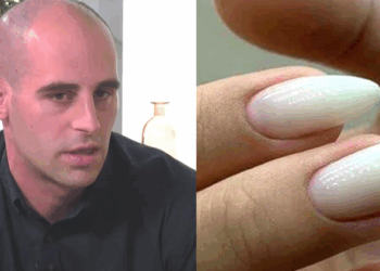 „ეს არის ძალიან საგანგაშო ჩვენი ორგანიზმისთვის“ – ზაზა თელია განმარტავს, რატომ არის სიცოცხლისთვის საშიში “შილაკის” 1 პროცედურაც კი