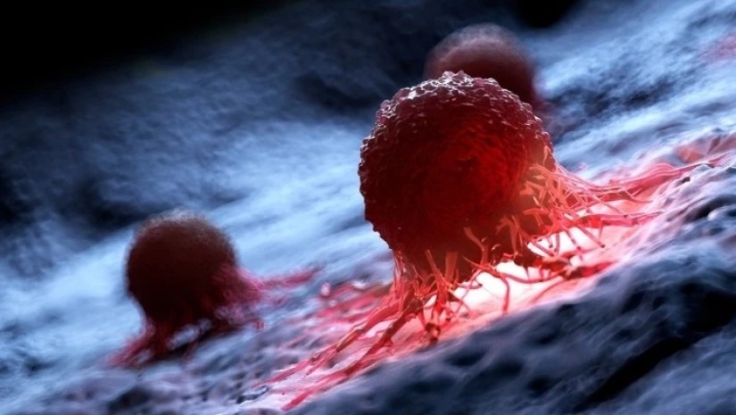 სიმსივნის ნიშნები, რომლებიც შესაძლოა, გვიან ღამით გამოვლინდეს – ექიმების გაფრთხილება