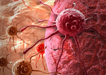 კიბოს 3 ნიშანი, რომლებიც, შეიძლება, ჭამის დროს გამოვლინდეს