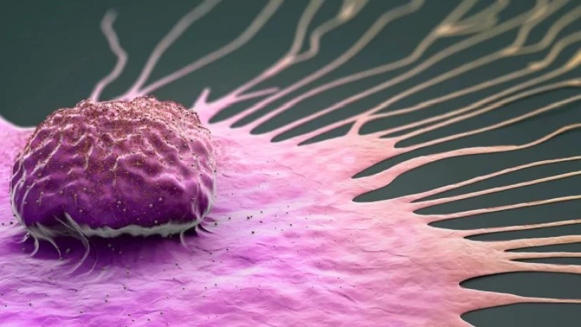 სიმსივნის ნიშნები, რომლებიც შესაძლოა, გვიან ღამით გამოვლინდეს – ექიმების გაფრთხილება