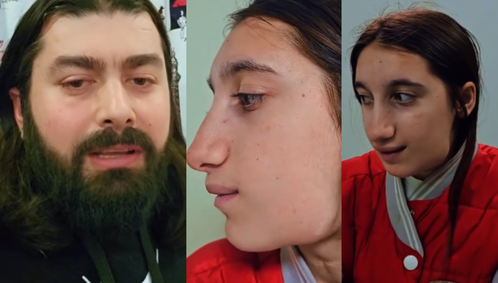 “მარიამის მდგომარეობა უამრავ ადამიანს აინტერესებდა, თამაშის დროს სახეში მოხვდა ხელი და…”- რა ვიდეოს აქვეყნებს ფოტოგრაფი დანტესი მარიამ კოხრეიძის შესახებ ?