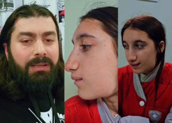 “მარიამის მდგომარეობა უამრავ ადამიანს აინტერესებდა, თამაშის დროს სახეში მოხვდა ხელი და…”- რა ვიდეოს აქვეყნებს ფოტოგრაფი დანტესი მარიამ კოხრეიძის შესახებ ?