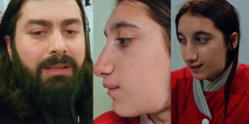 “მარიამის მდგომარეობა უამრავ ადამიანს აინტერესებდა, თამაშის დროს სახეში მოხვდა ხელი და…”- რა ვიდეოს აქვეყნებს ფოტოგრაფი დანტესი მარიამ კოხრეიძის შესახებ ?